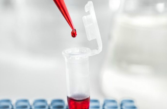 癫痫发作要怎么护理好呢